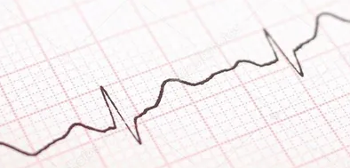 cardiac chart